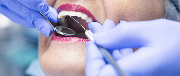Best Emergency Dental Care for Abscessed Tooth in Pomona, KS